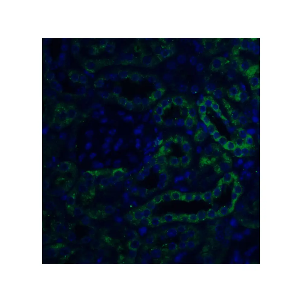 ProSci 4651 Slc22A17 Antibody, ProSci, 0.1 mg/Unit Tertiary Image