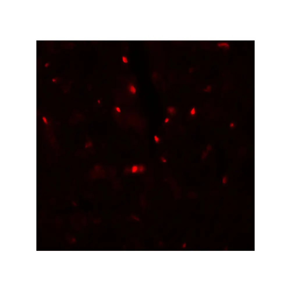 ProSci 7297 SLC27A6 Antibody, ProSci, 0.1 mg/Unit Tertiary Image