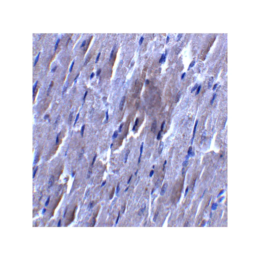 ProSci 7297 SLC27A6 Antibody, ProSci, 0.1 mg/Unit Secondary Image