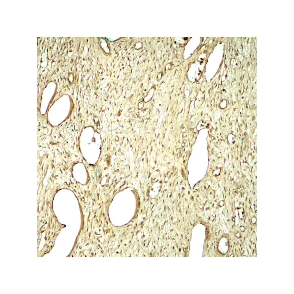 ProSci 8125 SLC29A1 Antibody, ProSci, 0.1 mg/Unit Secondary Image