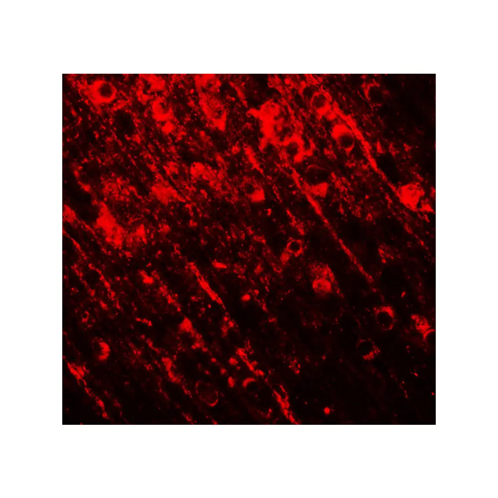 ProSci 7749_S SMARCA4 Antibody, ProSci, 0.02 mg/Unit Tertiary Image