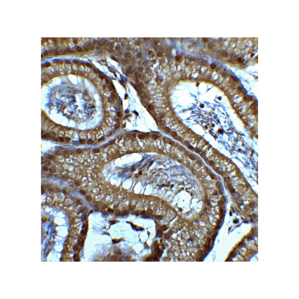 ProSci 7749_S SMARCA4 Antibody, ProSci, 0.02 mg/Unit Quaternary Image