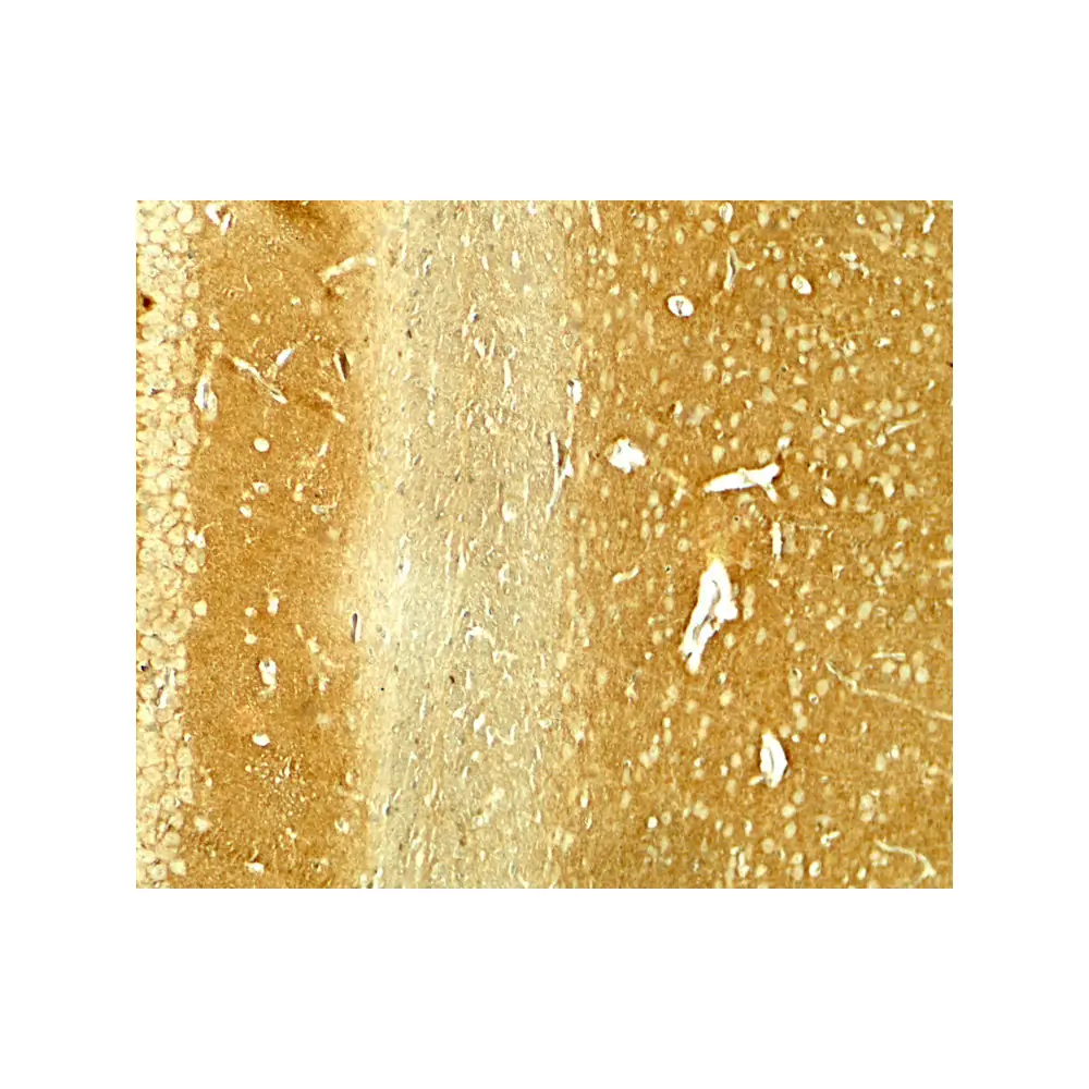 ProSci 7911 SNCA Antibody, ProSci, 0.1 mg/Unit Secondary Image