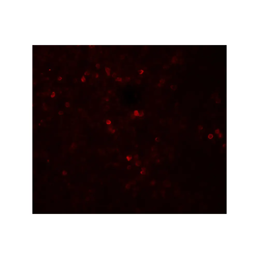 ProSci 8155_S SNRPN Antibody, ProSci, 0.02 mg/Unit Tertiary Image