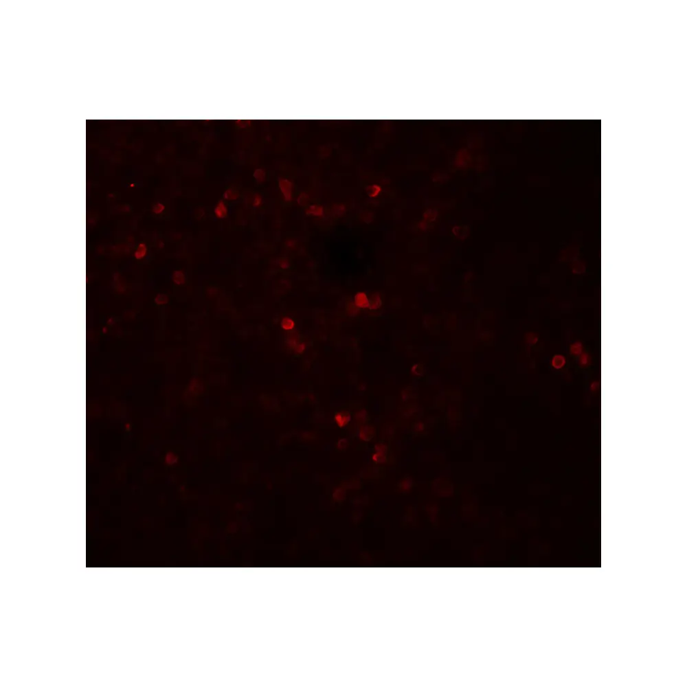 ProSci 8155 SNRPN Antibody, ProSci, 0.1 mg/Unit Tertiary Image