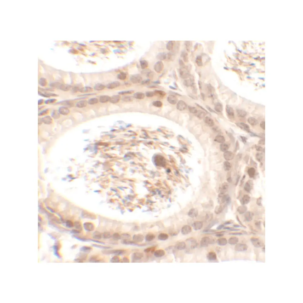 ProSci 6551_S SPATA3 Antibody, ProSci, 0.02 mg/Unit Secondary Image