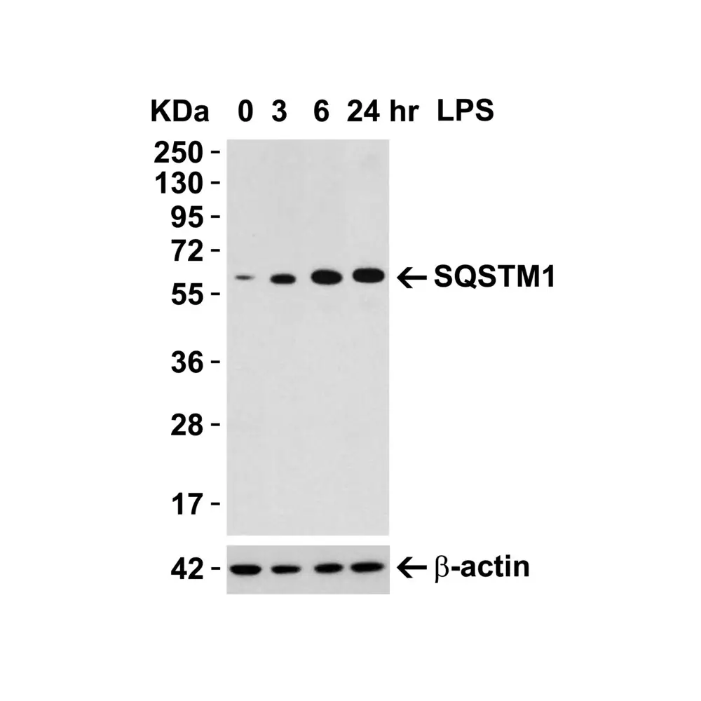 ProSci 5449 SQSTM1 Antibody, ProSci, 0.1 mg/Unit Tertiary Image