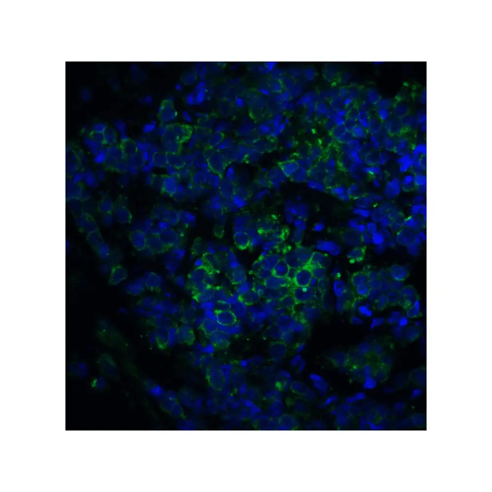 ProSci 3363_S ST2 Antibody, ProSci, 0.02 mg/Unit Senary Image