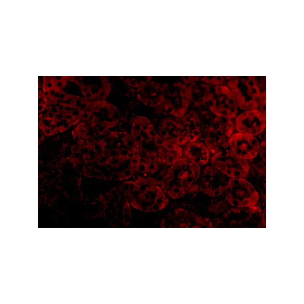 ProSci 3363 ST2 Antibody, ProSci, 0.1 mg/Unit Tertiary Image
