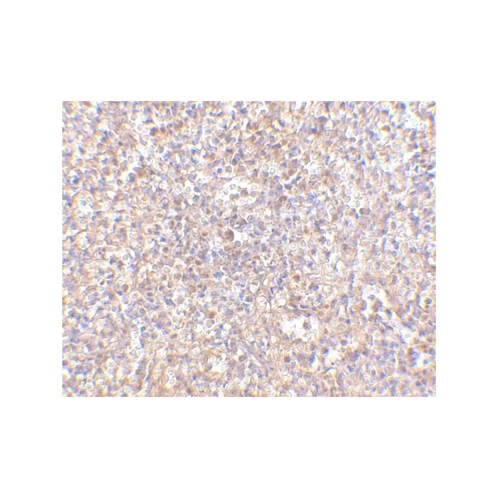 ProSci 4303_S STEAP1 Antibody, ProSci, 0.02 mg/Unit Secondary Image