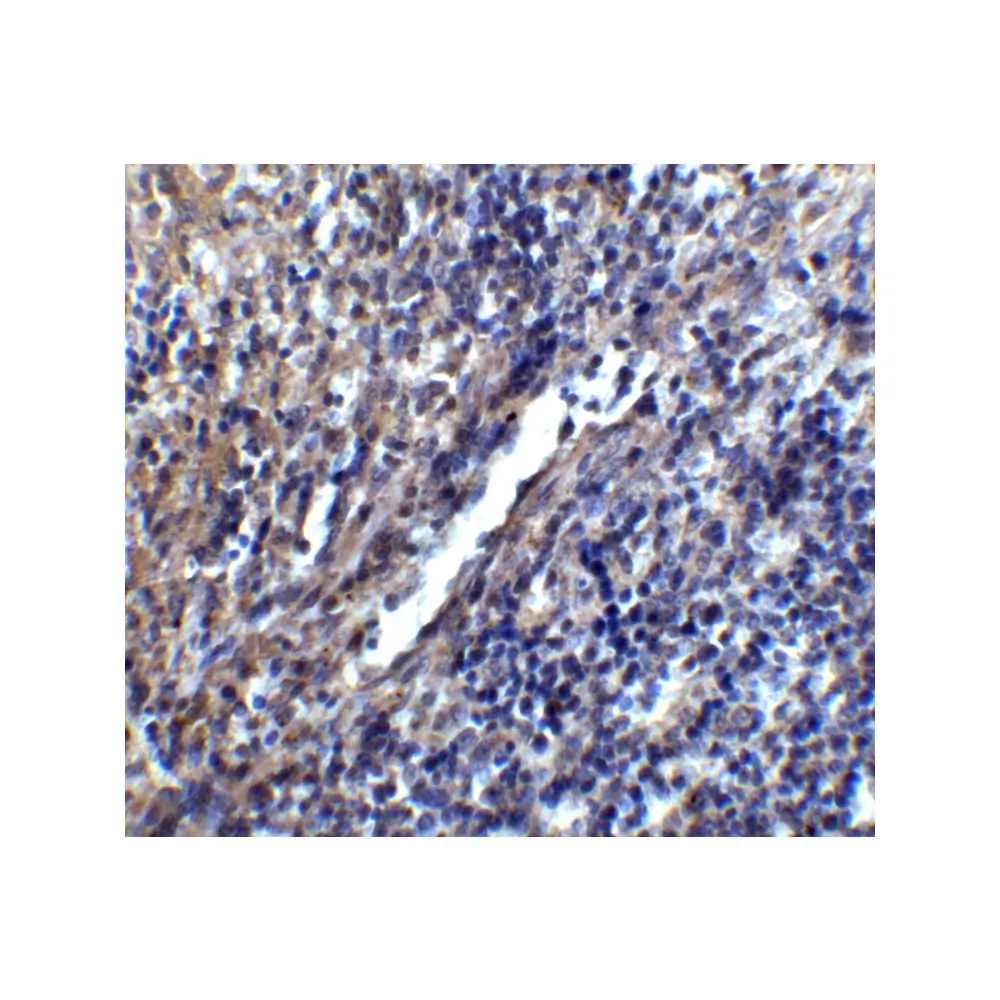 ProSci 4119_S STIM1 Antibody, ProSci, 0.02 mg/Unit Tertiary Image