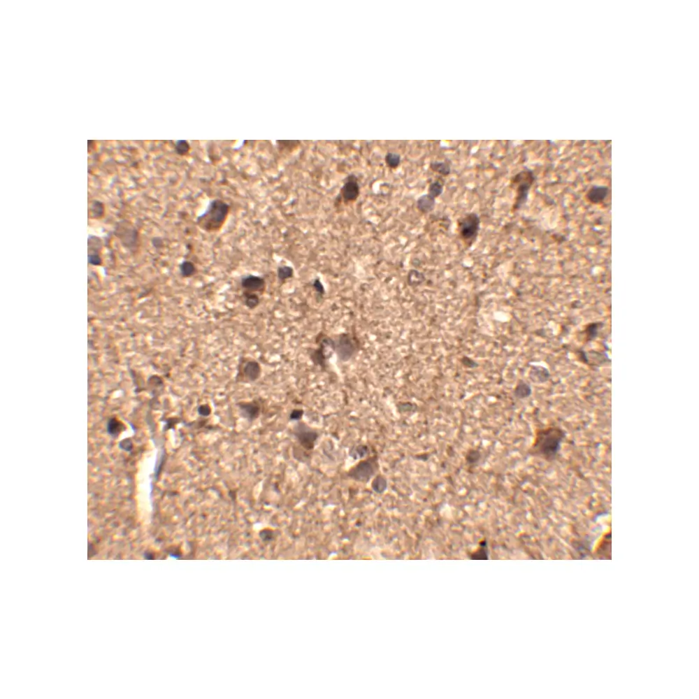 ProSci 4455 Slitrk1 Antibody, ProSci, 0.1 mg/Unit Secondary Image