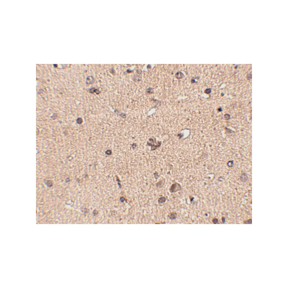 ProSci 4457_S Slitrk2 Antibody, ProSci, 0.02 mg/Unit Secondary Image
