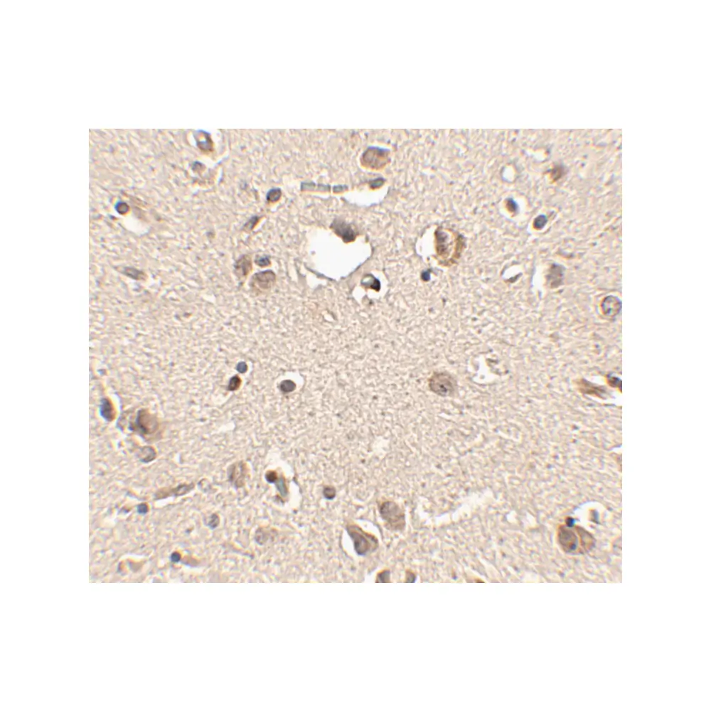 ProSci 4463 Slitrk3 Antibody, ProSci, 0.1 mg/Unit Secondary Image