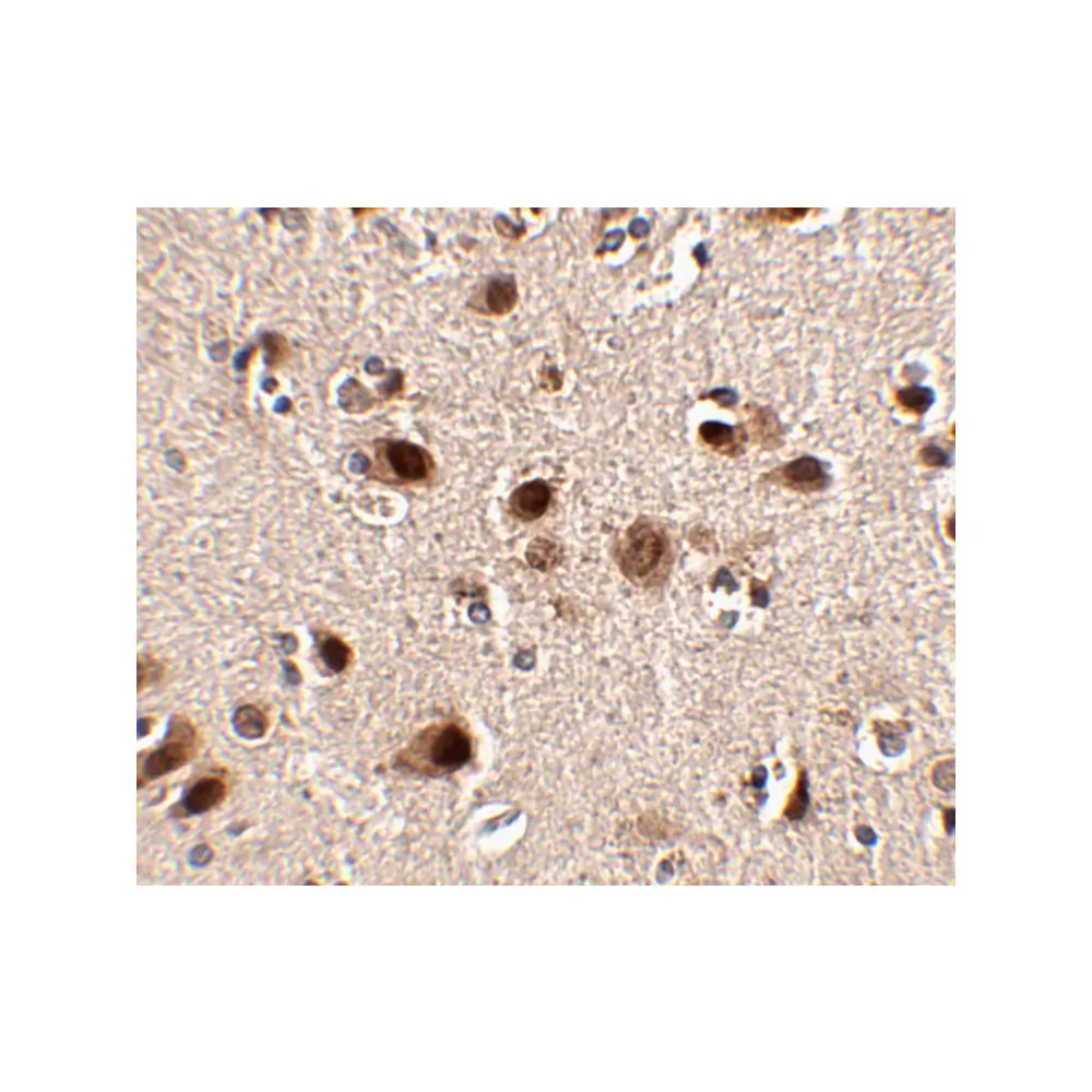 ProSci 4475_S Slitrk5 Antibody, ProSci, 0.02 mg/Unit Secondary Image