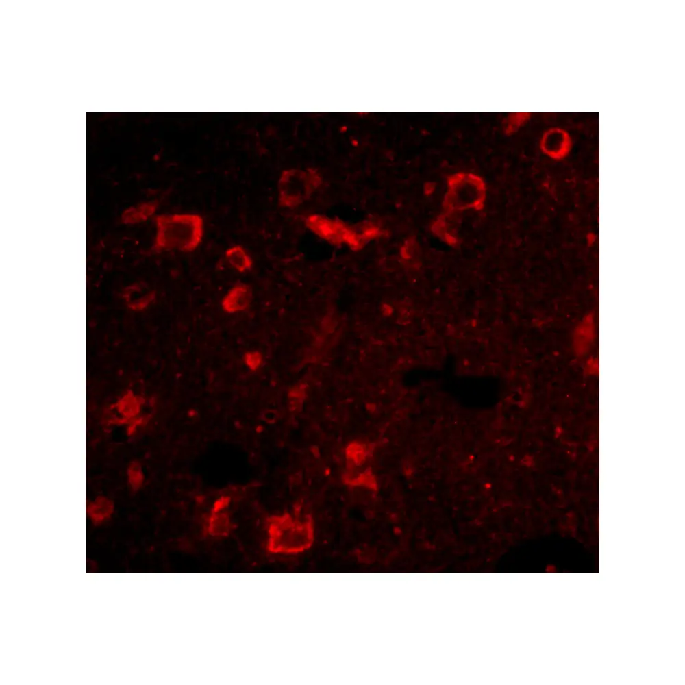 ProSci 4479 Slitrk6 Antibody, ProSci, 0.1 mg/Unit Tertiary Image
