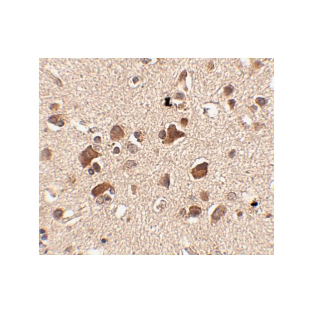 ProSci 4479 Slitrk6 Antibody, ProSci, 0.1 mg/Unit Secondary Image
