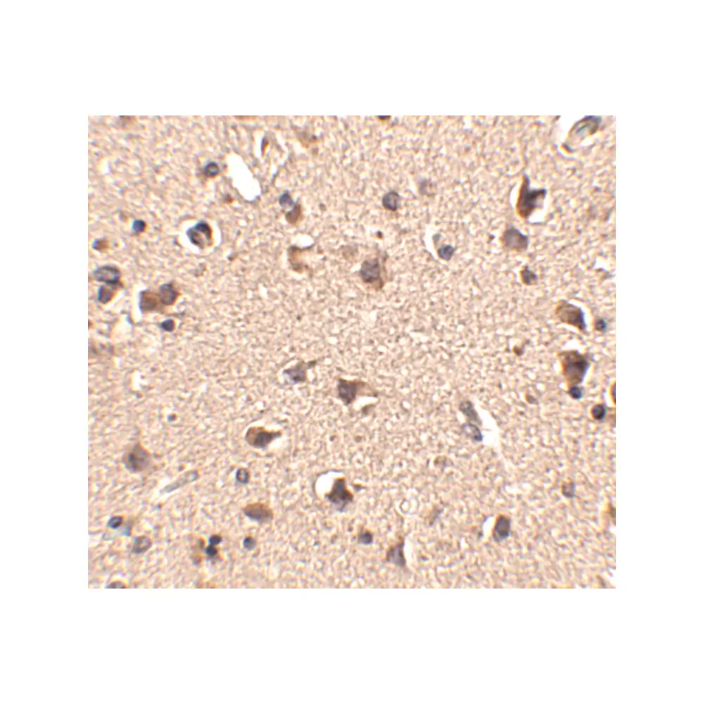 ProSci 4481_S Slitrk6 Antibody, ProSci, 0.02 mg/Unit Secondary Image