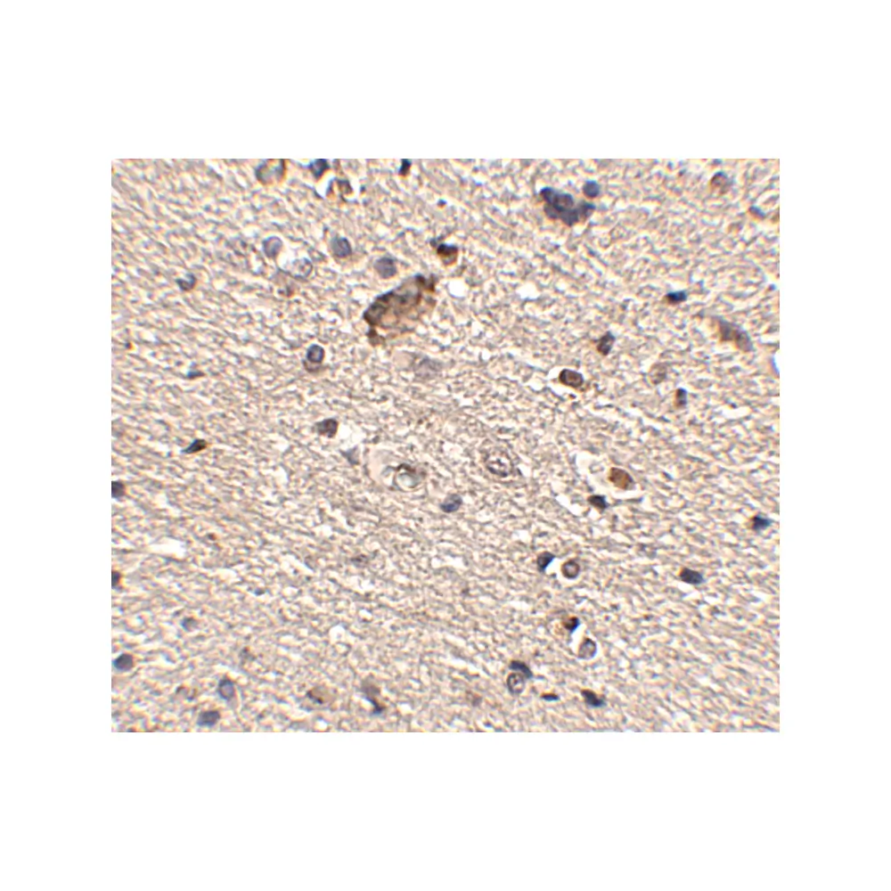 ProSci 4843_S Spred1 Antibody, ProSci, 0.02 mg/Unit Secondary Image