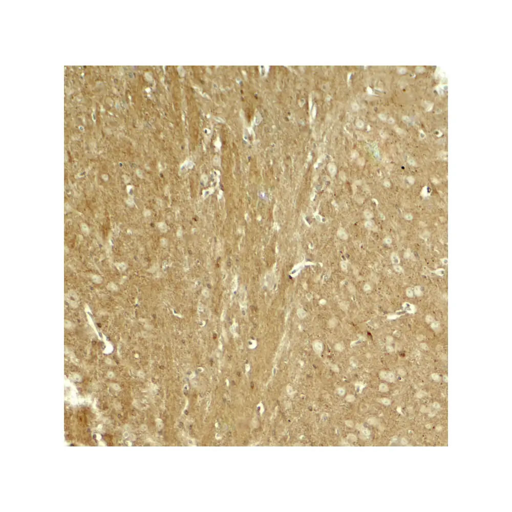 ProSci 8077_S TAU Antibody, ProSci, 0.02 mg/Unit Secondary Image