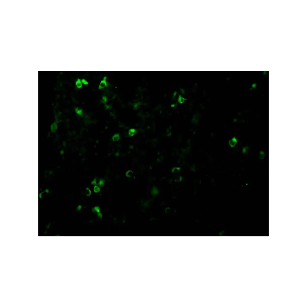 ProSci 2483 TCCR Antibody, ProSci, 0.1 mg/Unit Tertiary Image