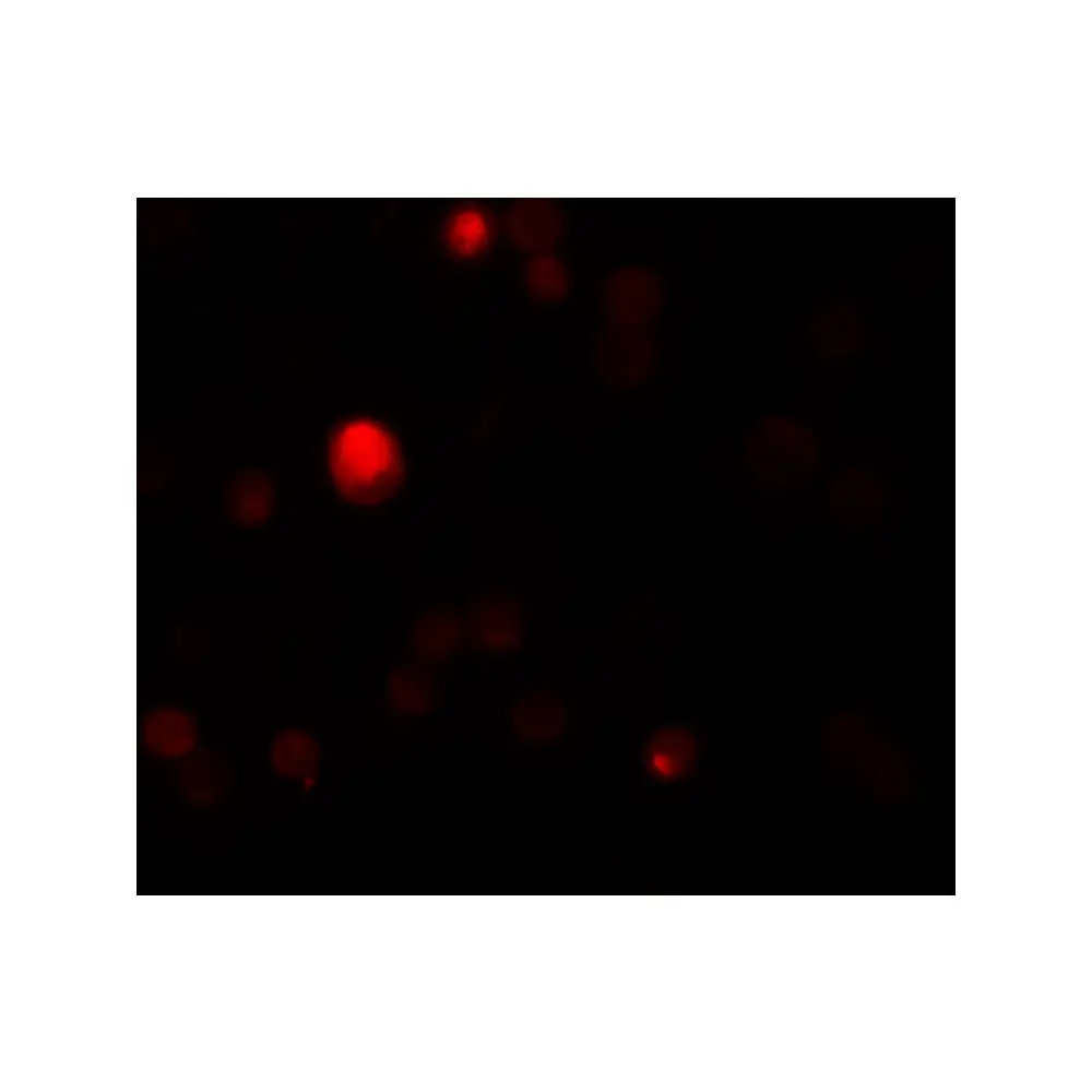 ProSci 5837 TCTN3 Antibody, ProSci, 0.1 mg/Unit Tertiary Image