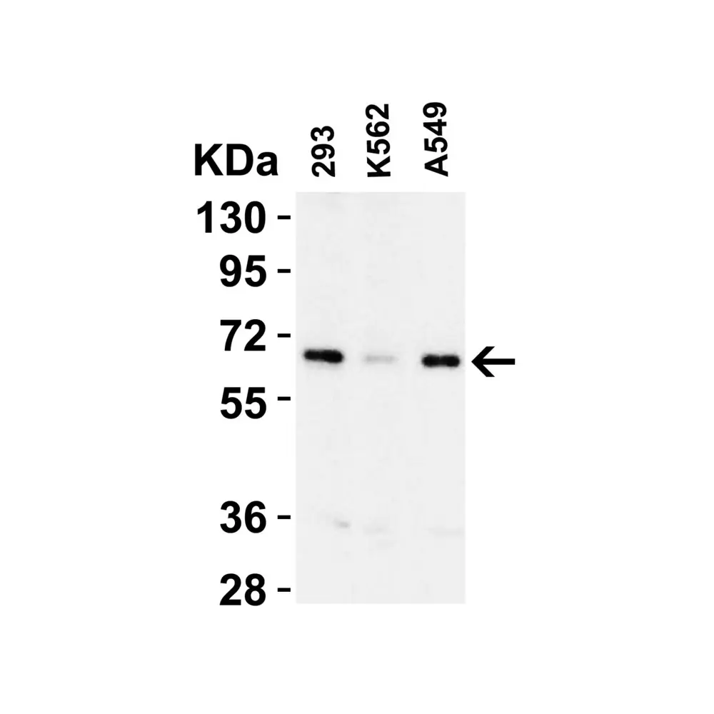 ProSci 3325_S cIAP Antibody, ProSci, 0.02 mg/Unit Tertiary Image