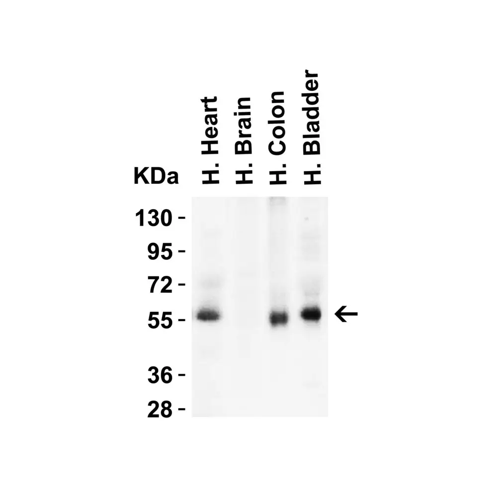 ProSci 8963 hRIP3 Antibody, ProSci, 0.1 mg/Unit Secondary Image