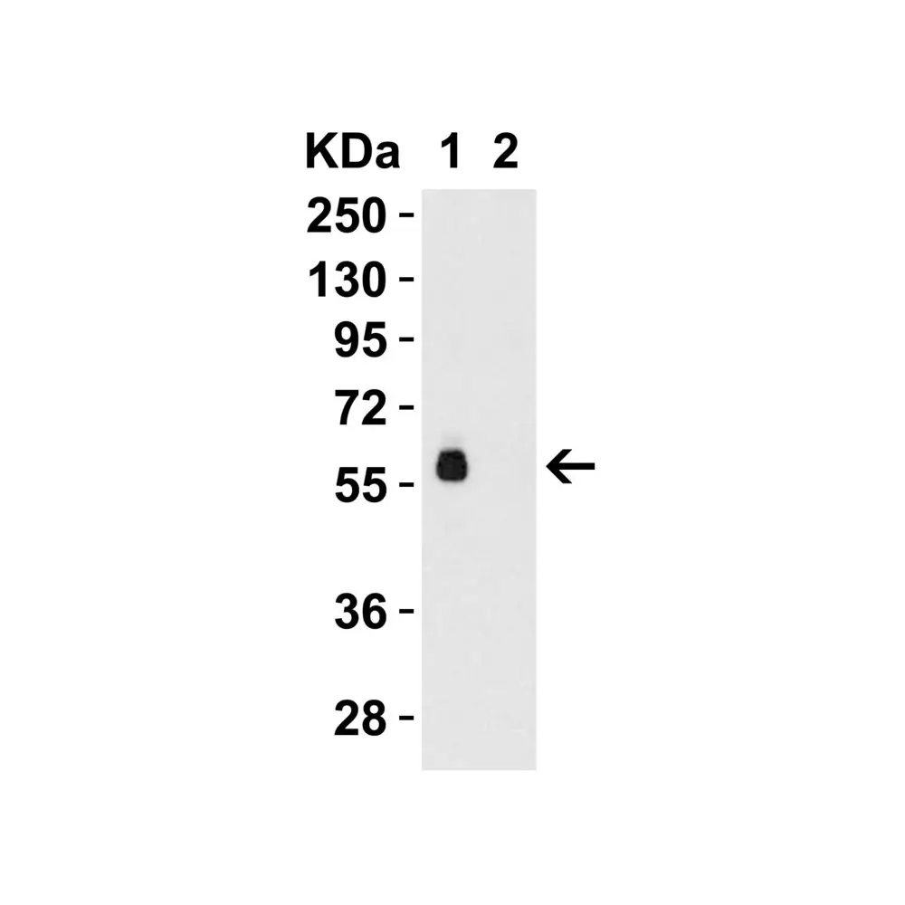 ProSci 8963 hRIP3 Antibody, ProSci, 0.1 mg/Unit Tertiary Image