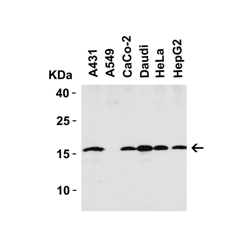 ProSci 4237_S op18 Antibody, ProSci, 0.02 mg/Unit Tertiary Image
