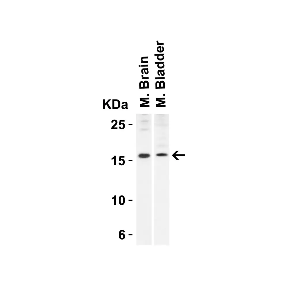 ProSci 4237_S op18 Antibody, ProSci, 0.02 mg/Unit Quaternary Image