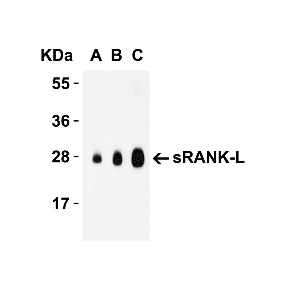 ProSci 3963 sRANK Ligand Antibody, ProSci, 0.1 mg/Unit Tertiary Image