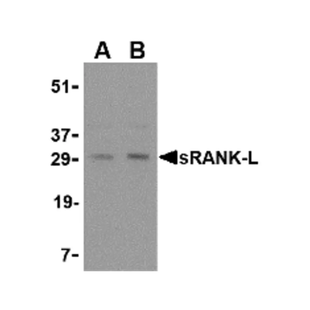 ProSci 3963 sRANK Ligand Antibody, ProSci, 0.1 mg/Unit Quaternary Image